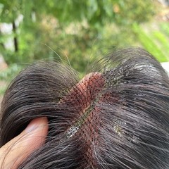 3.15″x4.3″ Traceless Thin Lace 100% Real Human Hair Topper Head Top Cover 10″