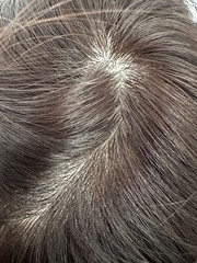 3.5″x4.3″Silk Top 100st Virgin Human Hair Topper For Women Clip in, 6″~14″