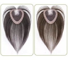 3″x4.3″ Front Lace Touch fastener Hook&loop 100% Human Hair Hairline Topper 10″