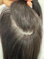 4.7″x5″Best Virgin Human Hair Toppers for Women, Free Part Silk Top Skin, 6″~18″