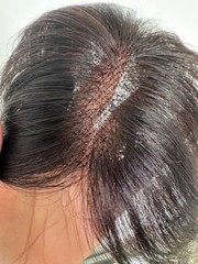 2.75″x4.3″Super Breathable Thin Light Lace 100% Human Hair Topper Wiglet Clip in