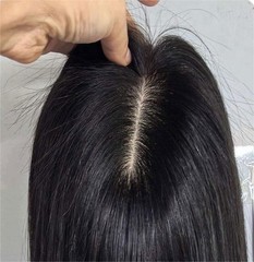 3.5″x5.5″/5″x6″Stick on Front Silk Top Base 100% Remy Human Hair Topper 12″~18″