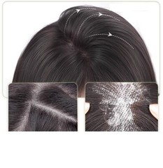 3″x4.3″ Front Lace Touch fastener Hook&loop 100% Human Hair Hairline Topper 10″