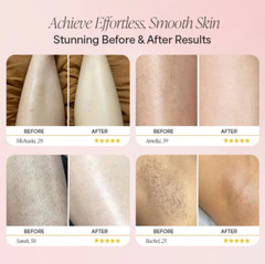The Trimmie 2.0 By Ezme Dermave Electric The Divine Shaver™