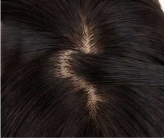 3.5″x5.5″Realistic Cap 100% Human Hair Topper For Women Cover Head Top 8″~12″