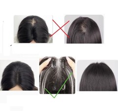 2.8″x4.7″Thin Lace 100%Human Hair Topper Cover Top Hairline Parting Line 10″~12″